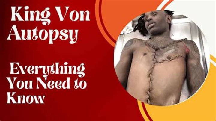 King Von Autopsy Unraveling the Truth Behind the Tragic Loss THE